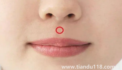 人中上的痣能去掉嗎2