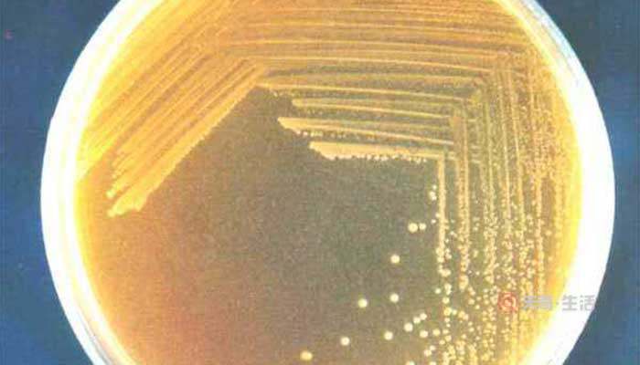 細(xì)菌菌落和真菌菌落的區(qū)別是什么 細(xì)菌菌落和真菌菌落怎么分辨(圖2) 細(xì)菌菌落和真菌菌落的區(qū)別是什么